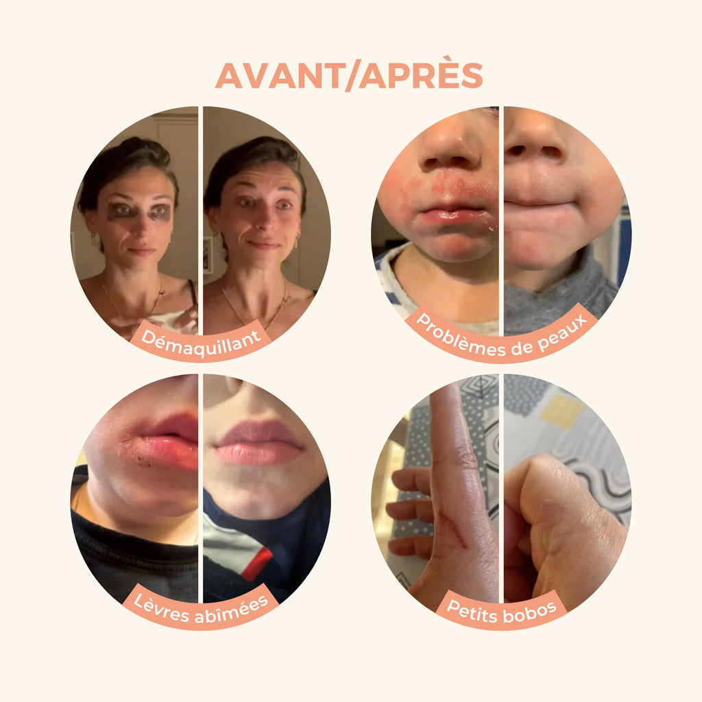 Avant apres baume magique