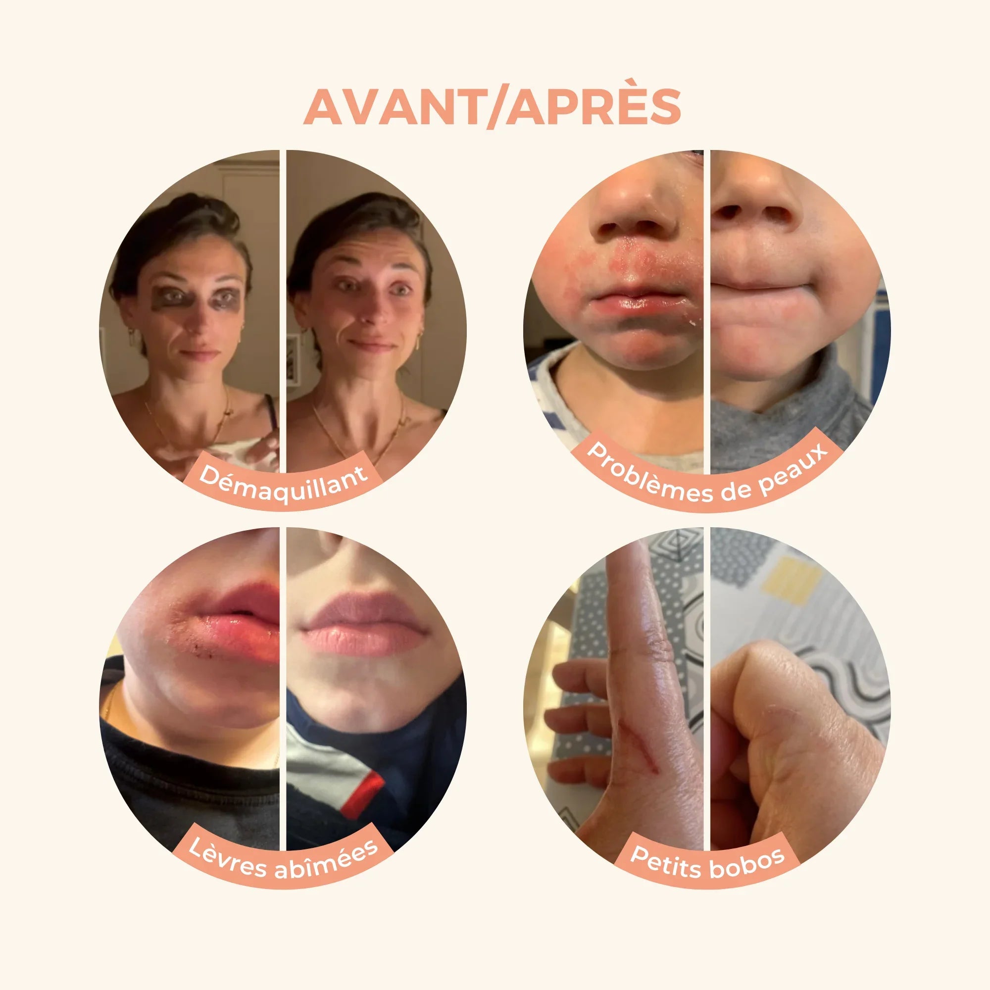 Avant apres baume magique
